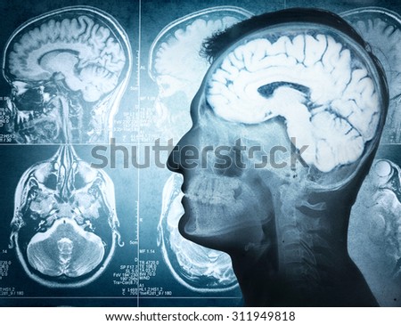 Conceptual image of a man from side profile showing brain and brain activity. Retro stale.