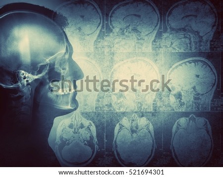 Conceptual image of a man from side profile showing brain and brain activity. Retro style.