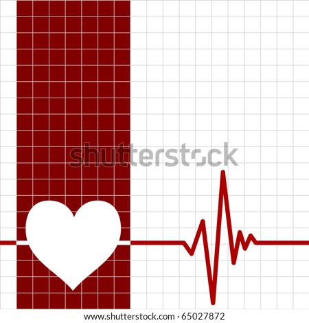Heart monitor Heart monitor