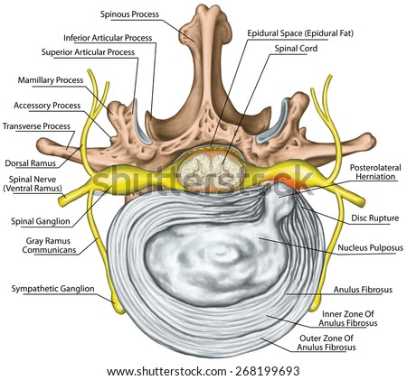 Lumbar disk herniation, herniated disc, lumbar vertebra, lumbar spine, intervertebral disk, nervous system, nerve root, spinal cord, vertebra,anatomy of human skeletal and nervous system,superior view
