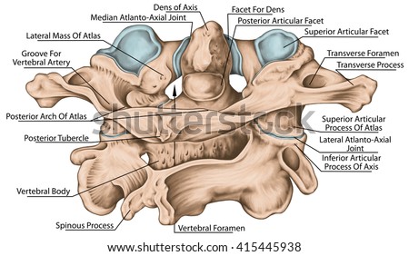 Didactic Board, Cervical Spine, Vertebral Morphology, First And Second