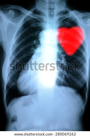 x-ray red heart of human