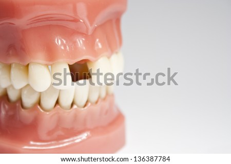 Artificial jaw missing a tooth
