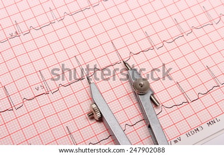 Electrocardiogram graph and calipers, ekg heart rhythm, medicine concept
