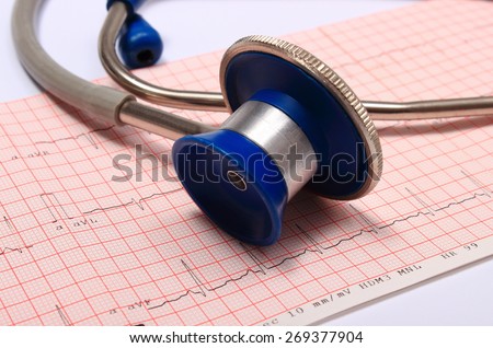Medical stethoscope and electrocardiogram graph ekg heart rhythm, medicine concept