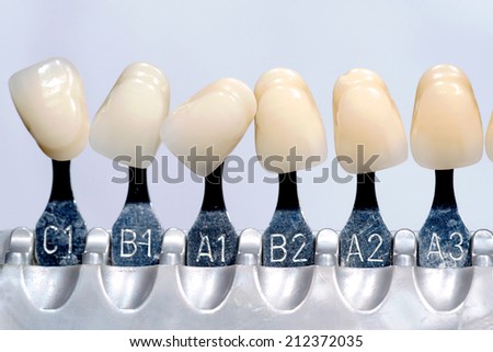Plastic Dental implant to choose color tone of teeth