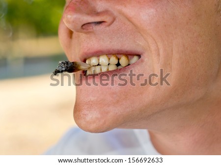 Close-up of the mouth of a man addicted to smoking with teeth affected by nicotine