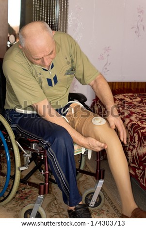 Senior man sitting in a wheelchair at home fitting a prosthetic leg following an above the knee amputation