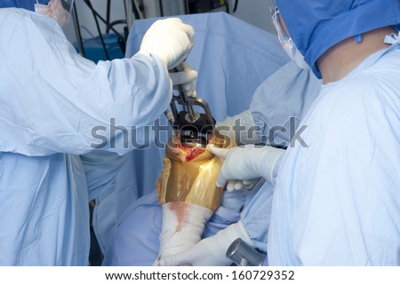 Detail of Surgery, Orthopedic Operation, Knee Surgery