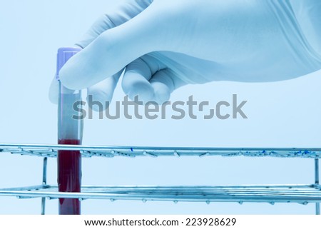hand of a scientific taking a blood sample tube/hand holding a tube test