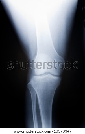 knee x-ray photo for background