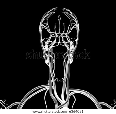 stock photo : Head and Neck X- arteries in neck and head. stock photo : Head and Neck X-