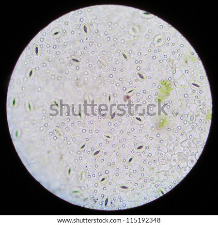 A rare educational material under microscope -- the section of the plant.These are guard cell.