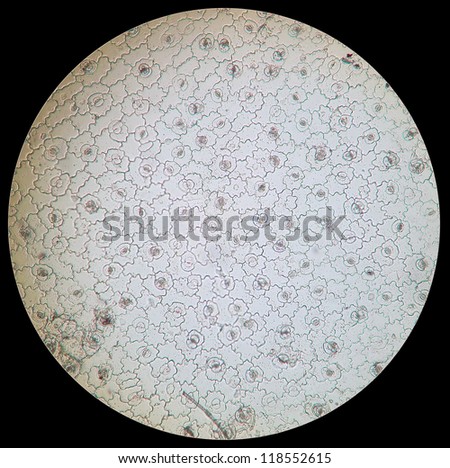 A rare educational material under microscope -- the section of the plant.These are guard cell and epidermic cells.