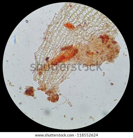 A rare educational material under microscope -- the section of the fragments of the root