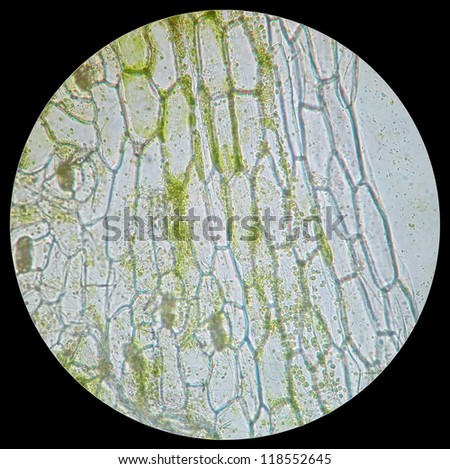 A rare educational material under microscope -- the section of the plant.These are guard cell and epidermic cells.