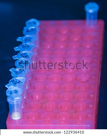 taking the sample for the DNA extracting, which show the first step