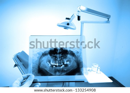 photo of full mouth dental xray(x-ray), blue tone