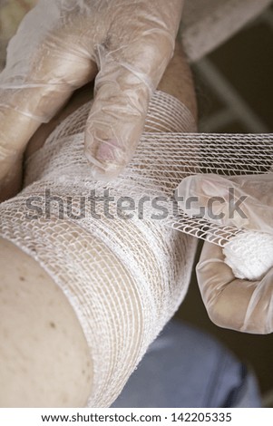 Arm bandage broken person, healing and first aid