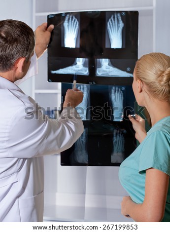 Orthopedic doctor shows x-ray of foot. Valgus foot