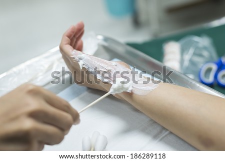 Wound dressing series : Closeup of nurse\'s hand applying white cream on patient\'s hand with burning injury