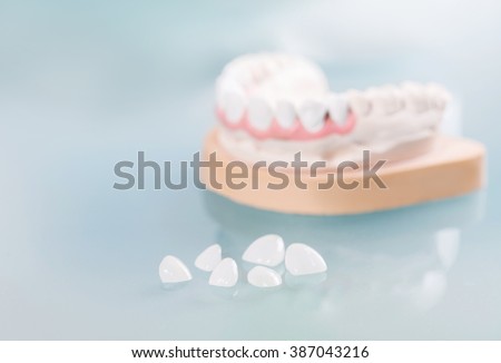Dental veneers are lying on a blue background in the laboratory.