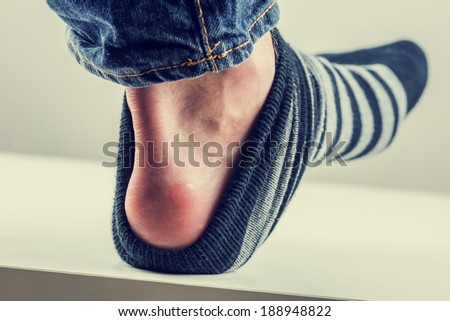 Man with a blister on his heel with his sock lifted down to reveal the raw red patch of rubbed skin. With a vintage instagram style filter effect.