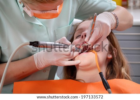 Dentist  drilling  tooth of a young patient, closeup, real people