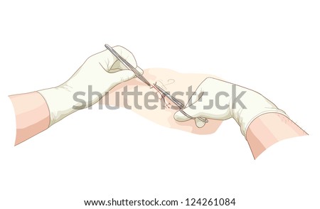 The Surgeon Takes In A Wound. Vector Illustration. - 124261084