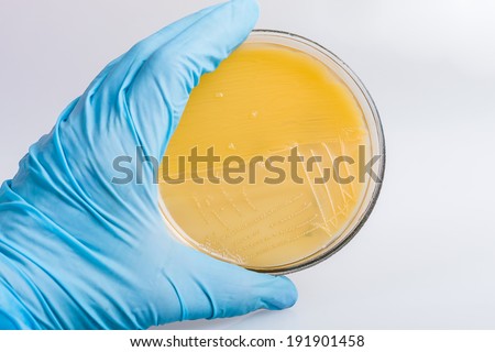 Hand in glove holding the petri dish with bacteria Streptococcus A.