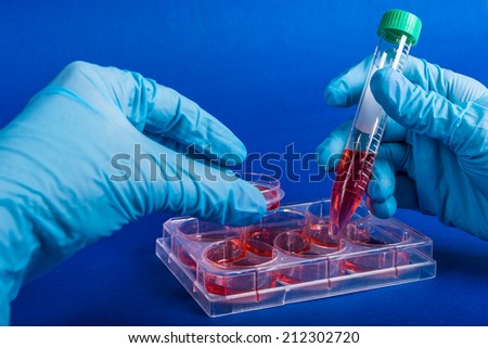 scientist holding a Petri dish and  tube with cell culture in sterile box