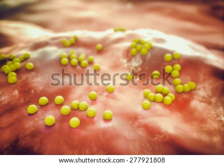 MRSA (Staphylococcus aureus) Bacteria