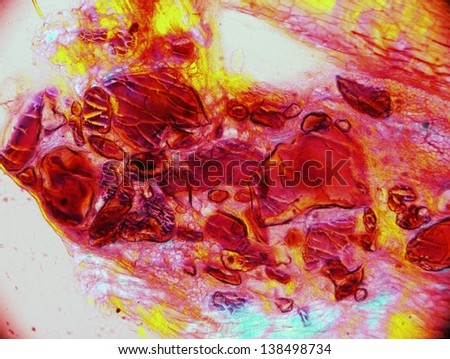 polarized light microscope bone tissue