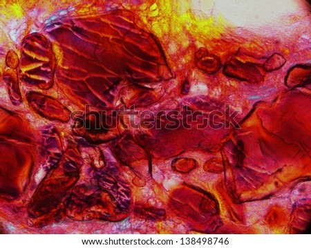 bone tissue seen by polarized light microscope