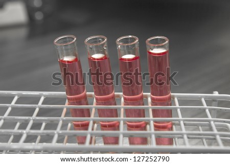 Test-tubes with blood sample in bio lab under studio lights