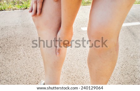Cramps in leg calves or sprain calf on triathlete runner sports injury with running woman