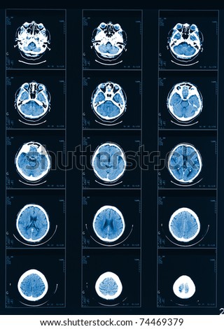 X-ray computed tomography fine head background