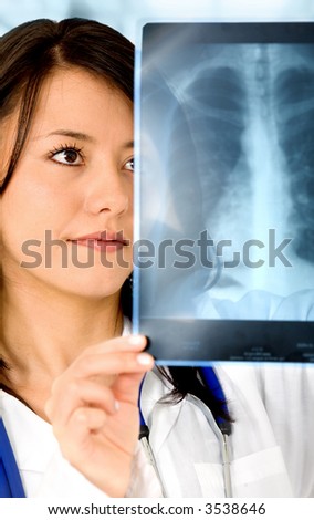 female doctor looking at a lungs or torso xray female doctor looking at a lungs or torso xray