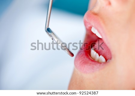 Close up of patients mouth in a visit to the dentist