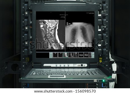 MRI CT Scanned image show on computer in DataCenter operation room.