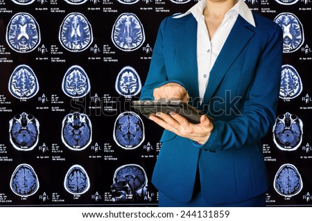 Woman using tablet pc on background X-ray image of the brain computed tomography