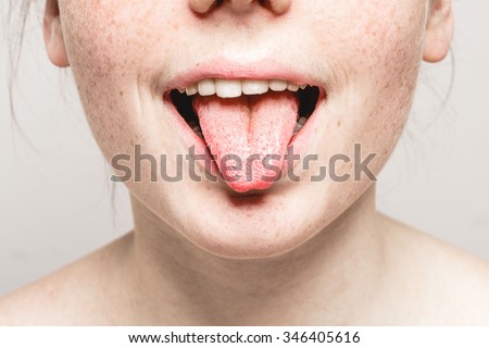 Tongue open mouth Young beautiful freckles woman face portrait with healthy skin