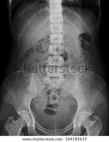 X-rays the pelvis and spinal column (L-Spine AP)