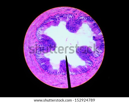 Wet mount vas ductus deferens microscopic cross section view male reproductive system