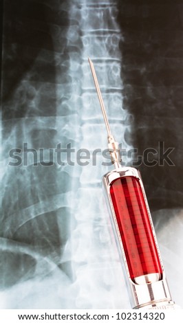 hypodermic needle and syringe in front of a radiograph