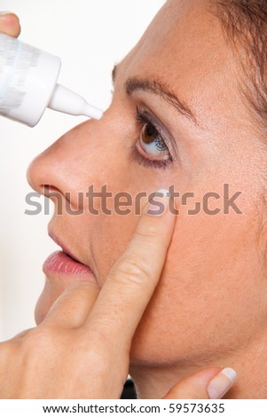 Women with allergies and eye drops. Hay fever. Instillation of the eye.