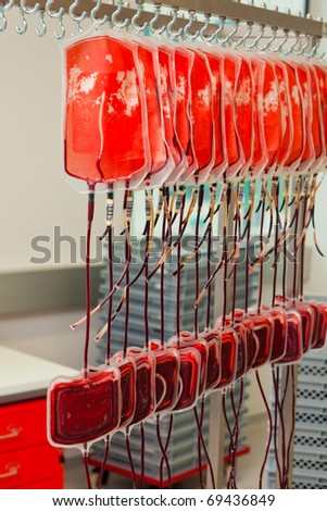 Blood from blood donors in the blood lab. Health and Welfare.