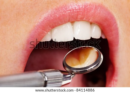 Teeth of a young woman to be examined by the dentist in the dental practice