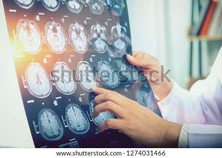 doctor give advice to patient about MRI (Xray) brain Scans