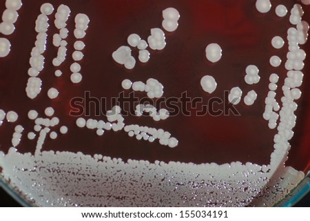 bacterial colonies growing in sheep blood medium on a petri dish